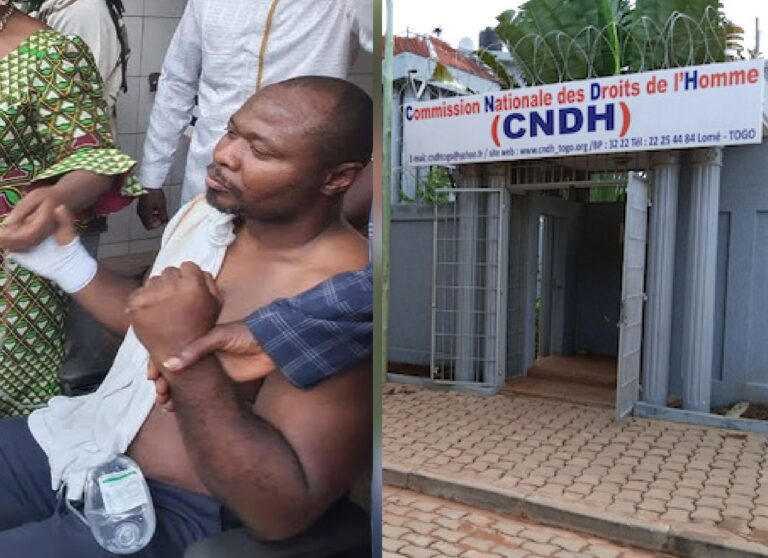 Togo/Agression de Guy Marius Sagna : L’exhortation de la CNDH au Gouvernement
