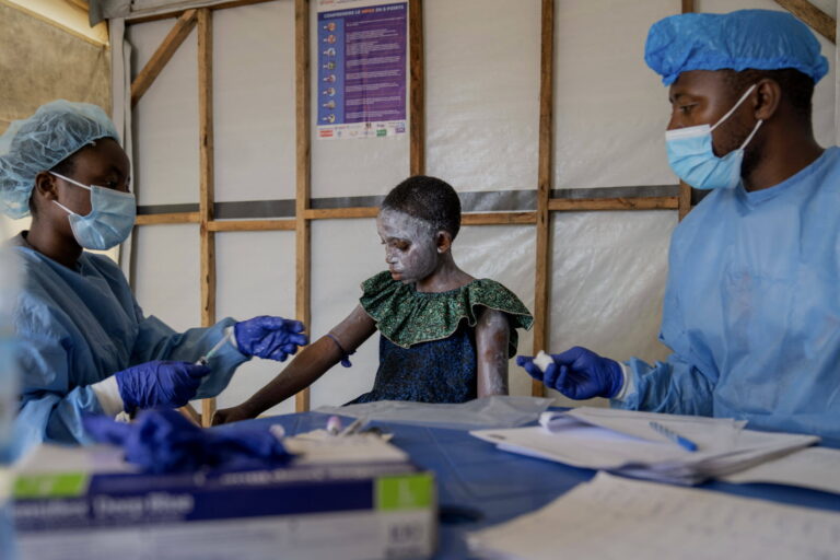 Un cas de Mpox confirmé à Lomé : le gouvernement appelle à la vigilance